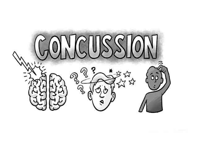 How to Tell If You Have a Concussion
