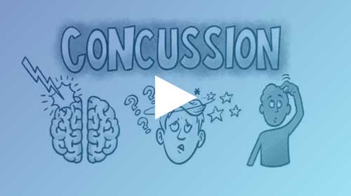 impact-baseline-test-what-is-concussion
